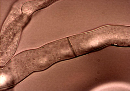 neurospora
